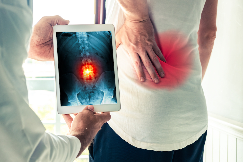 a doctor showing to her patient the X-ray result